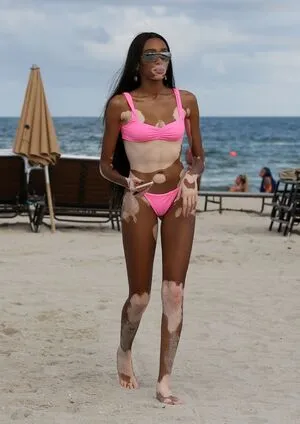 Winnie Harlow OnlyFans Leaked Free Thumbnail Picture - #Vzn8YPrGnV