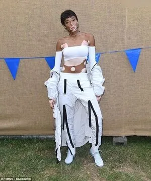 Winnie Harlow OnlyFans Leaked Free Thumbnail Picture - #X30oXETFfc