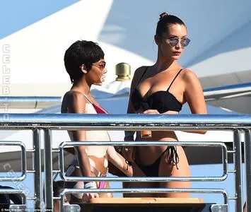 Winnie Harlow OnlyFans Leaked Free Thumbnail Picture - #XAPdK5th0a