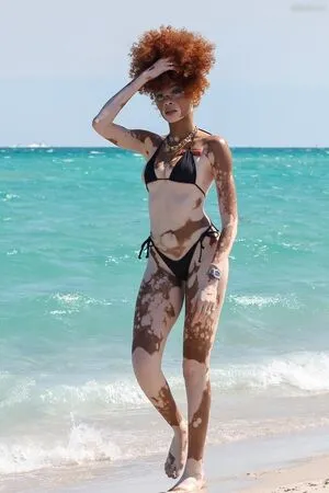 Winnie Harlow OnlyFans Leaked Free Thumbnail Picture - #XLMX3oeLiO