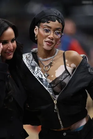 Winnie Harlow OnlyFans Leaked Free Thumbnail Picture - #XryUuHcHS3