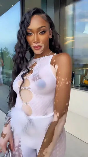 Winnie Harlow OnlyFans Leaked Free Thumbnail Picture - #YKMs3m7Yui