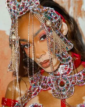 Winnie Harlow OnlyFans Leaked Free Thumbnail Picture - #YQnwSAWdcA
