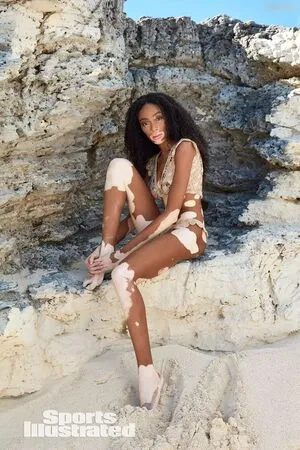 Winnie Harlow OnlyFans Leaked Free Thumbnail Picture - #YSroEhwo72