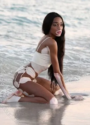 Winnie Harlow OnlyFans Leaked Free Thumbnail Picture - #YdXMqvmkCL
