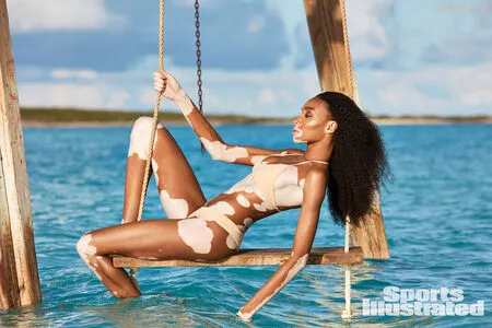 Winnie Harlow OnlyFans Leaked Free Thumbnail Picture - #Yo6GatjJfK