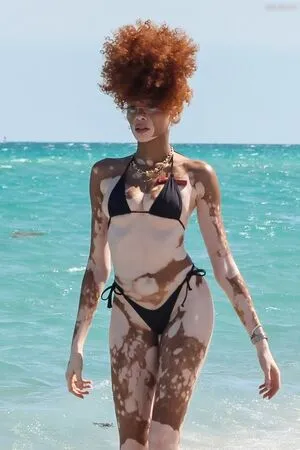 Winnie Harlow OnlyFans Leaked Free Thumbnail Picture - #ZiSOtUpJ2n