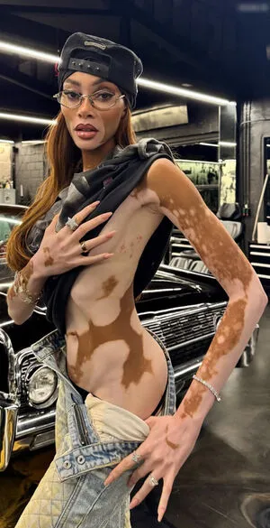 Winnie Harlow OnlyFans Leaked Free Thumbnail Picture - #Znp2BmfB0d