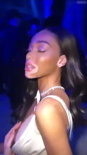 Winnie Harlow OnlyFans Leaked Free Thumbnail Picture - #ZuwPWG5iWu