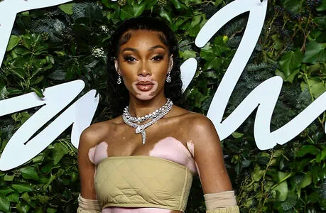 Winnie Harlow OnlyFans Leaked Free Thumbnail Picture - #ZvOcTQ4wDp