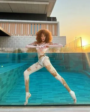 Winnie Harlow OnlyFans Leaked Free Thumbnail Picture - #aQL2c084qu
