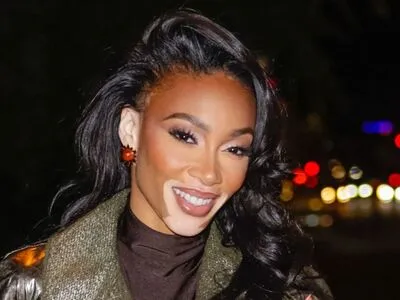 Winnie Harlow OnlyFans Leaked Free Thumbnail Picture - #aUImlPLfBW