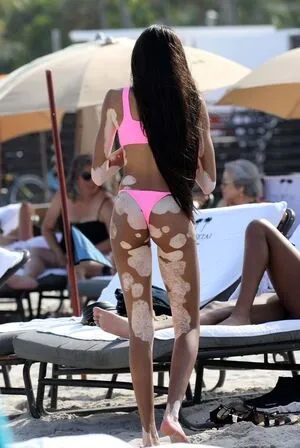 Winnie Harlow OnlyFans Leaked Free Thumbnail Picture - #amOdyA0VJe