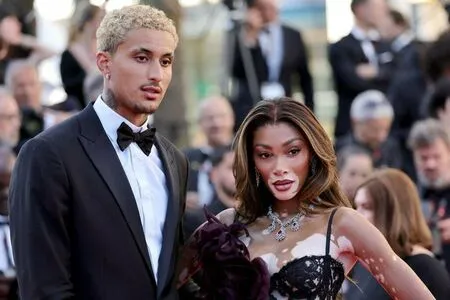 Winnie Harlow OnlyFans Leaked Free Thumbnail Picture - #auV8fcMBvW