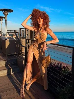Winnie Harlow OnlyFans Leaked Free Thumbnail Picture - #b2QkpDIzed