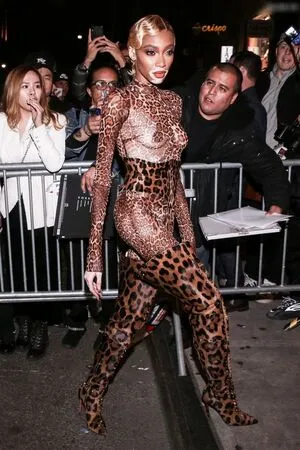 Winnie Harlow OnlyFans Leaked Free Thumbnail Picture - #bQoJMUK3PY