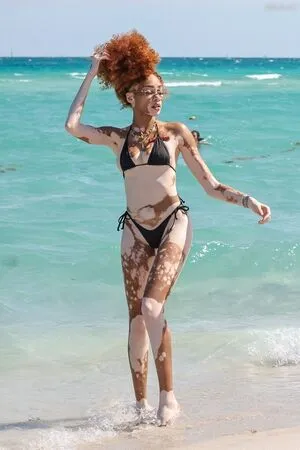 Winnie Harlow OnlyFans Leaked Free Thumbnail Picture - #bW5aFo8nj9