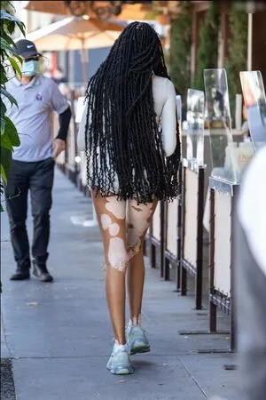 Winnie Harlow OnlyFans Leaked Free Thumbnail Picture - #bqvJDAge6V