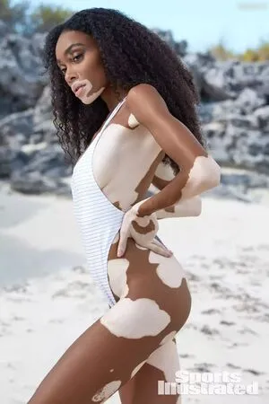 Winnie Harlow OnlyFans Leaked Free Thumbnail Picture - #cFRZA8V8Iq