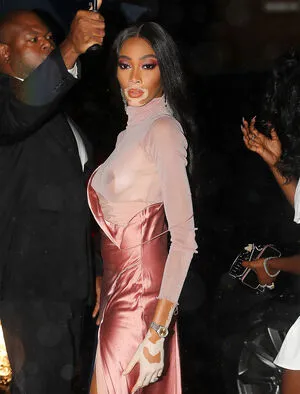 Winnie Harlow OnlyFans Leaked Free Thumbnail Picture - #cOL0DFma1z