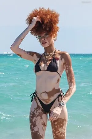 Winnie Harlow OnlyFans Leaked Free Thumbnail Picture - #cld39PsrzN