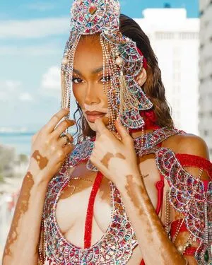 Winnie Harlow OnlyFans Leaked Free Thumbnail Picture - #d8FyrMwvEP