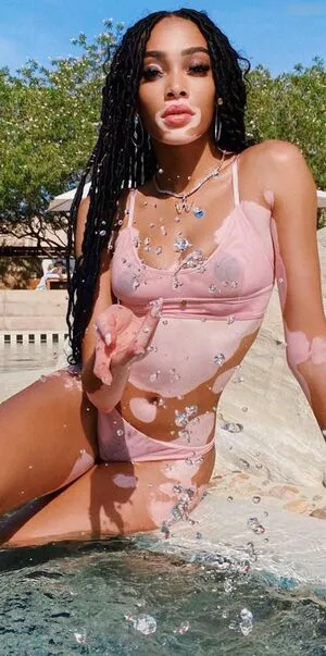 Winnie Harlow OnlyFans Leaked Free Thumbnail Picture - #dHLly0BcRg