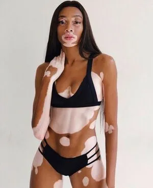 Winnie Harlow OnlyFans Leaked Free Thumbnail Picture - #dbxFB3UjIn