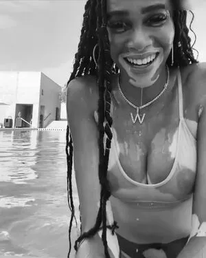 Winnie Harlow OnlyFans Leaked Free Thumbnail Picture - #fJt2nnIxsG