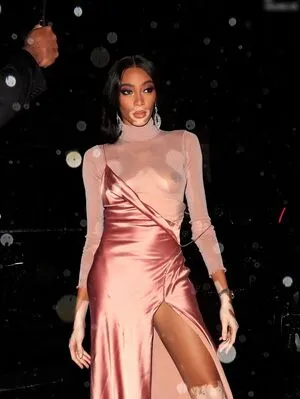 Winnie Harlow OnlyFans Leaked Free Thumbnail Picture - #gDDKBD8dhK
