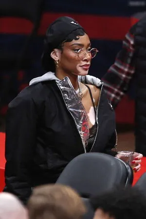 Winnie Harlow OnlyFans Leaked Free Thumbnail Picture - #gzk9GMcjmY