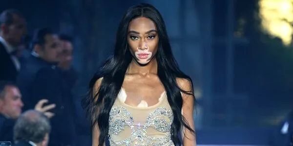 Winnie Harlow OnlyFans Leaked Free Thumbnail Picture - #h5LS5j9MqW