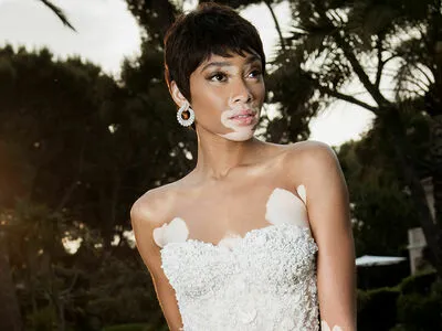 Winnie Harlow OnlyFans Leaked Free Thumbnail Picture - #hIREcpG0Pa