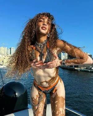 Winnie Harlow OnlyFans Leaked Free Thumbnail Picture - #hLnE4WY0GE