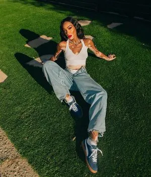 Winnie Harlow OnlyFans Leaked Free Thumbnail Picture - #hX2VC7wigR