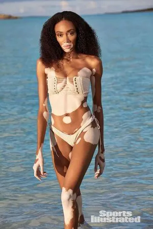 Winnie Harlow OnlyFans Leaked Free Thumbnail Picture - #hfPfQZlMIO