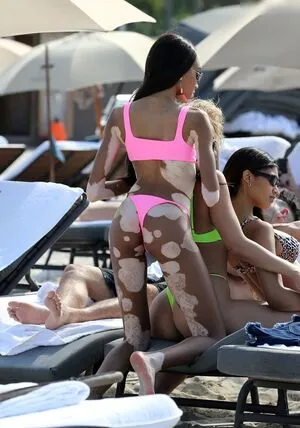 Winnie Harlow OnlyFans Leaked Free Thumbnail Picture - #hfQ7e0GSEw
