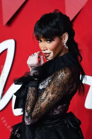 Winnie Harlow OnlyFans Leaked Free Thumbnail Picture - #hiJwzgO4nS