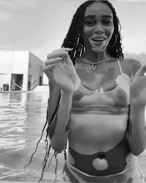 Winnie Harlow OnlyFans Leaked Free Thumbnail Picture - #ht4yZHB2Vu