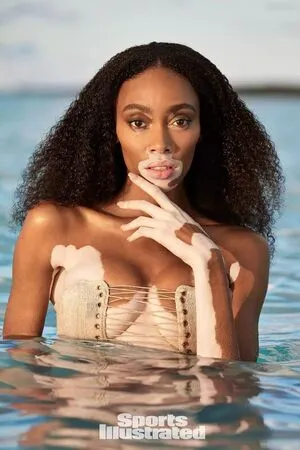 Winnie Harlow OnlyFans Leaked Free Thumbnail Picture - #i5jua5bRGD