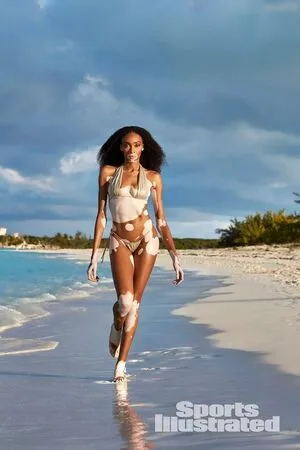 Winnie Harlow OnlyFans Leaked Free Thumbnail Picture - #iMkWmgwssA