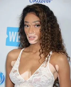 Winnie Harlow OnlyFans Leaked Free Thumbnail Picture - #iQkEqyLF6Z