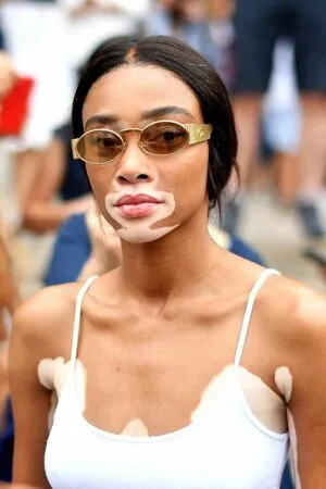 Winnie Harlow OnlyFans Leaked Free Thumbnail Picture - #ibz0I0y3FC