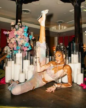 Winnie Harlow OnlyFans Leaked Free Thumbnail Picture - #jHnvENQuqF