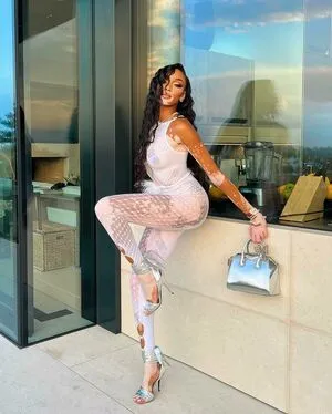 Winnie Harlow OnlyFans Leaked Free Thumbnail Picture - #jK3mel5lRf