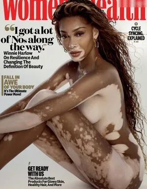 Winnie Harlow OnlyFans Leaked Free Thumbnail Picture - #jO3UX8j1Ga