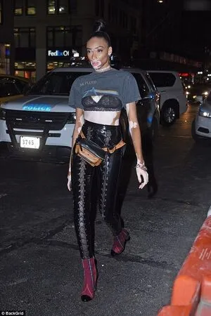 Winnie Harlow OnlyFans Leaked Free Thumbnail Picture - #jWxVd89Xzt