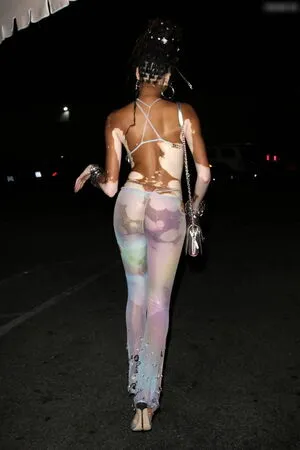 Winnie Harlow OnlyFans Leaked Free Thumbnail Picture - #jbh67TGpmB