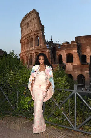 Winnie Harlow OnlyFans Leaked Free Thumbnail Picture - #jcyct6bigL