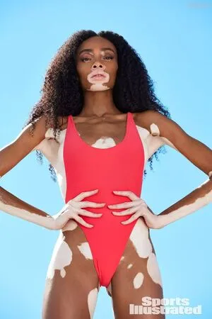 Winnie Harlow OnlyFans Leaked Free Thumbnail Picture - #jdVLpCB7AO